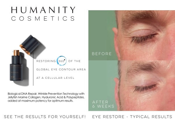 
                  
                    RESTAURATION DES YEUX
                  
                