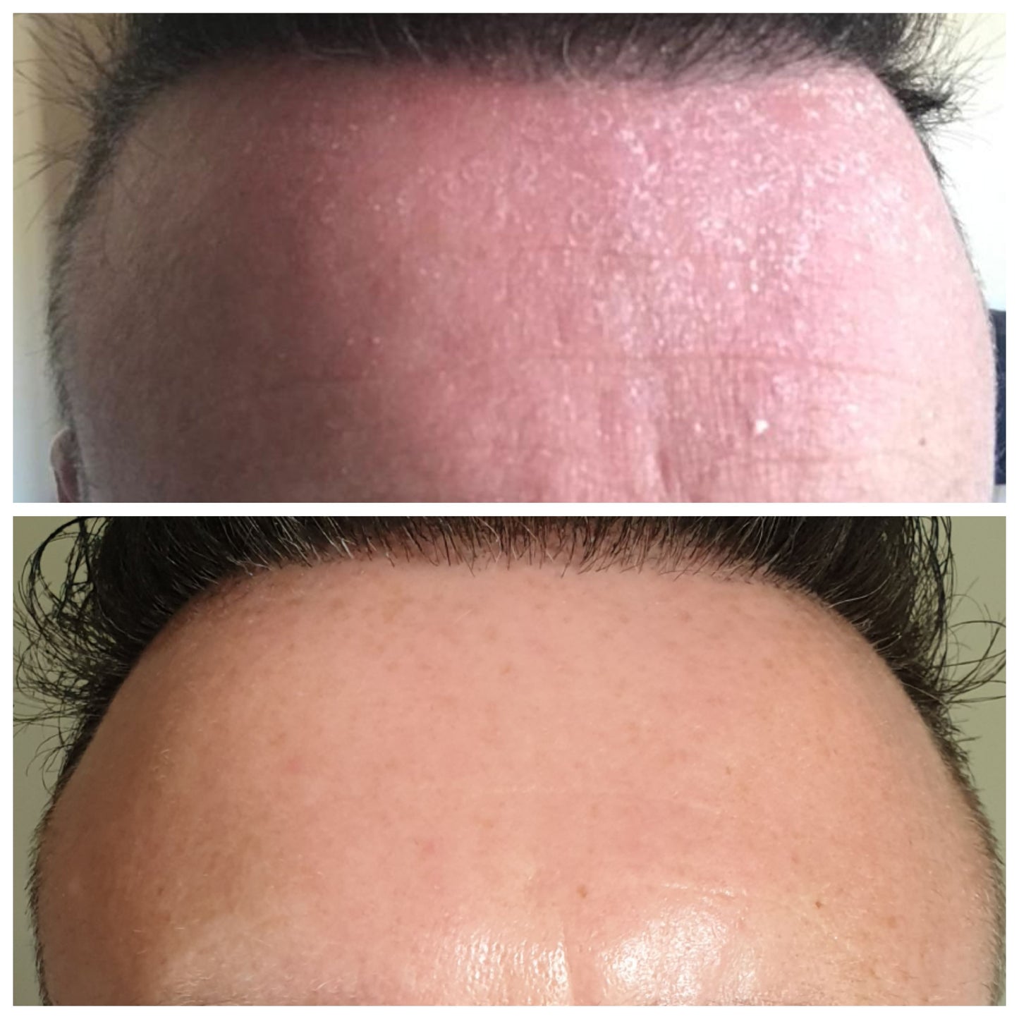 
                  
                    FACE POLISH
                  
                